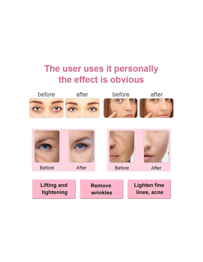 Dispositivo De Limpeza De Rejuvenescimento