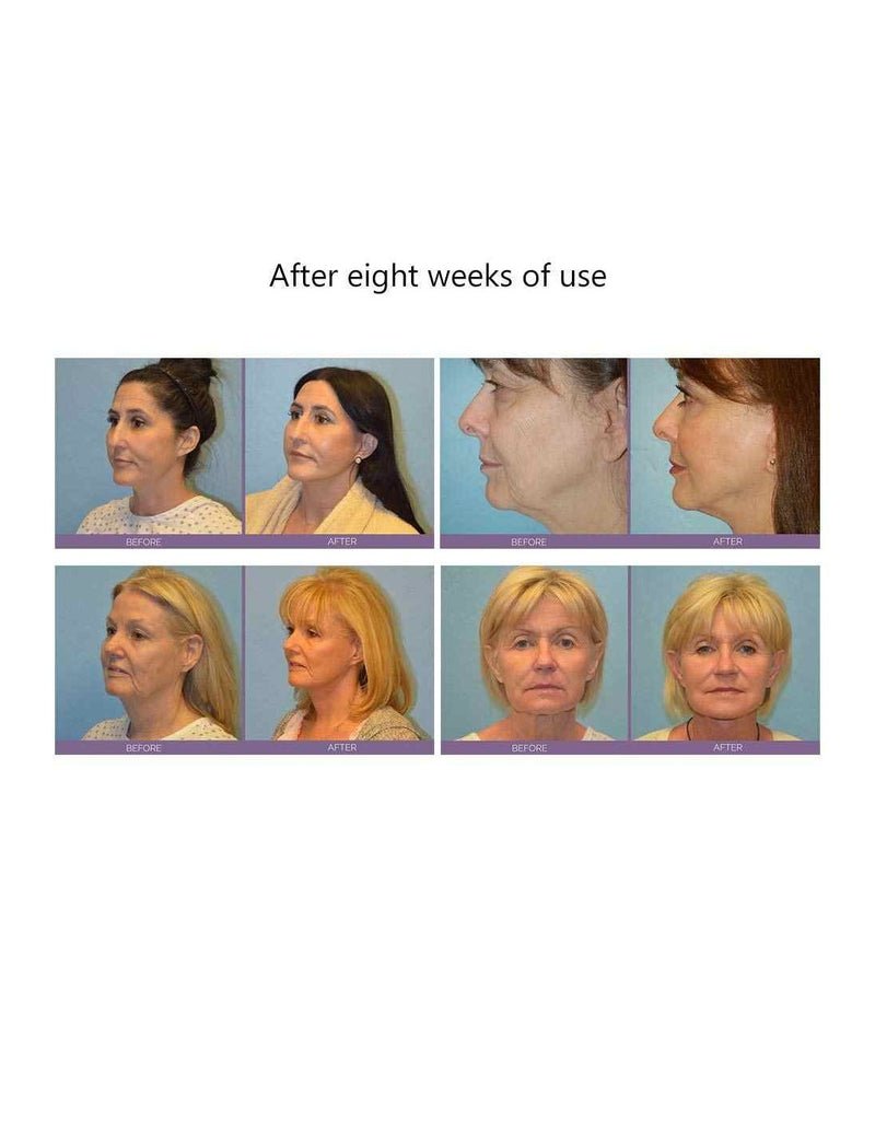 Dispositivo Mini Facial Toning de Cara