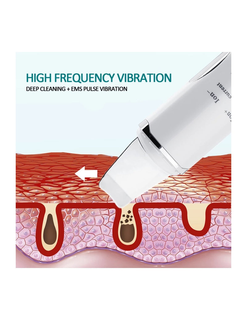 Espátula Ultrassónica para Limpeza Facial
