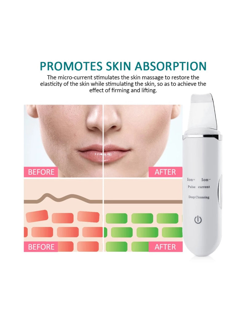 Espátula Ultrassónica para Limpeza Facial