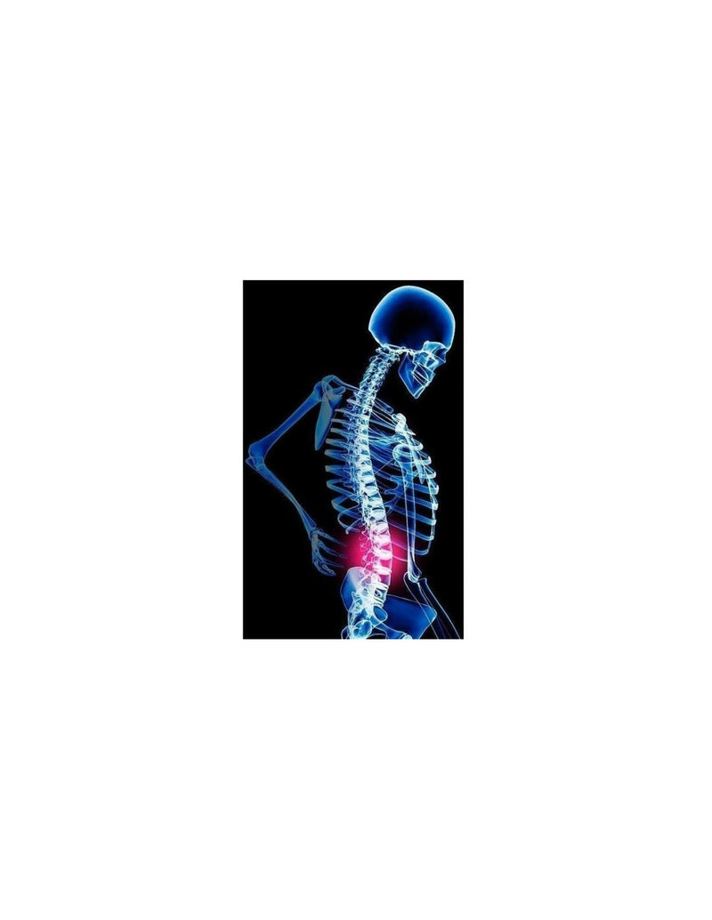 Suporte de Correção para Costas c/ Estacas de Neoprene